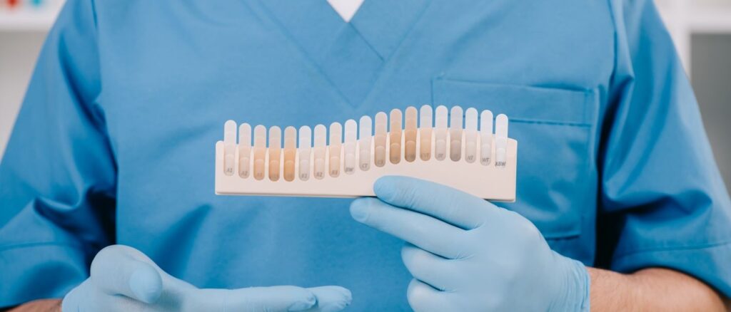 Dentist holding a tooth shade guide for composite bonding — color matching for a hollywood smile
