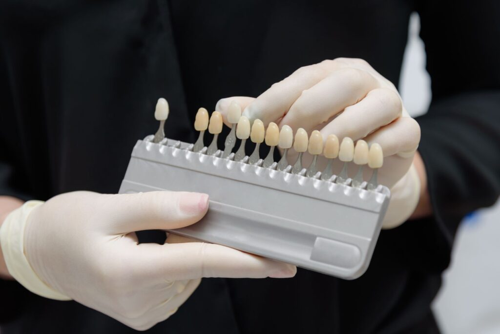 Dentist in gloves holding a shade guide of dental veneers.