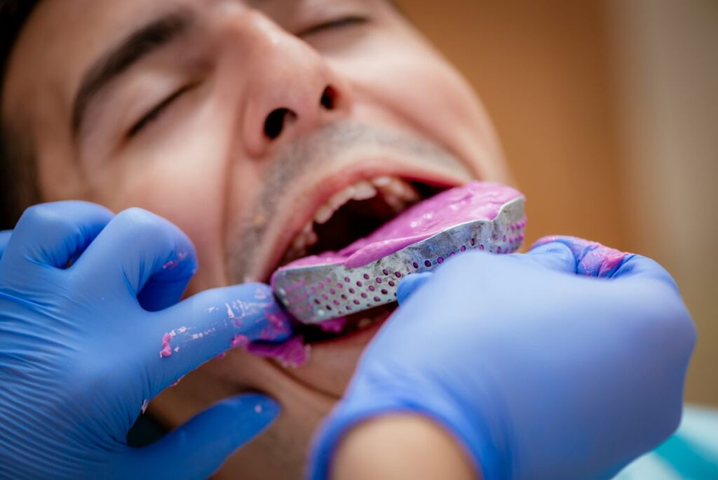 Dentist taking a dental impression to check fit and bite before final placement of restorations