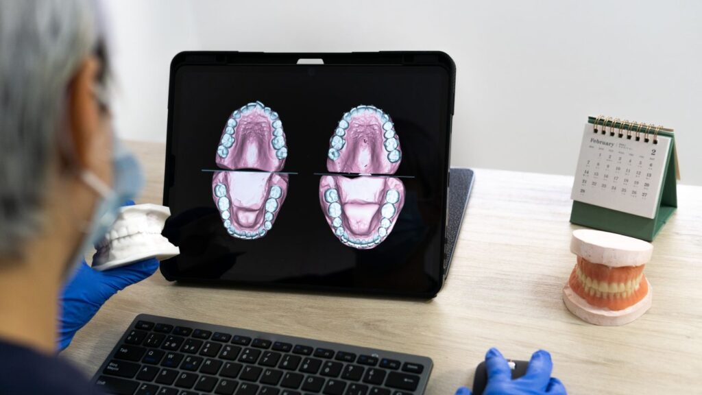 Dentist reviewing digital dental scans on a tablet, explaining risks of veneers and irreversible enamel removal.