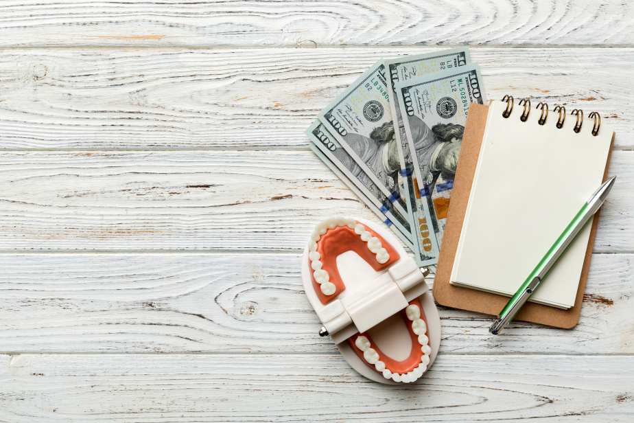 Planning affordable Hollywood smile treatment with a dental model, dollar bills, and a notepad on a wooden table