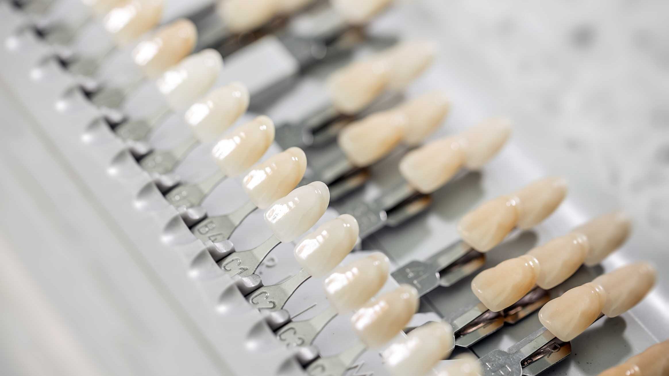 Dental shade guide with porcelain veneer samples in multiple tones, showing how material choice and smile design affect color matching and the final look.