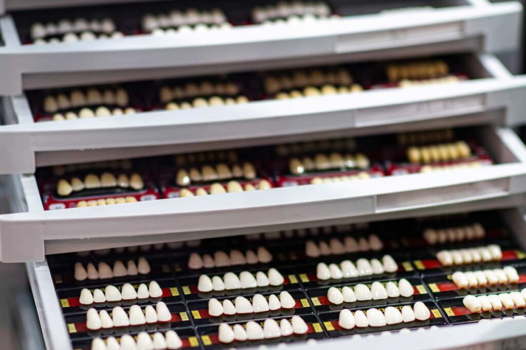 Dental veneer shade samples in a clinic drawer, illustrating treatment options for a hollywood smile in italy.