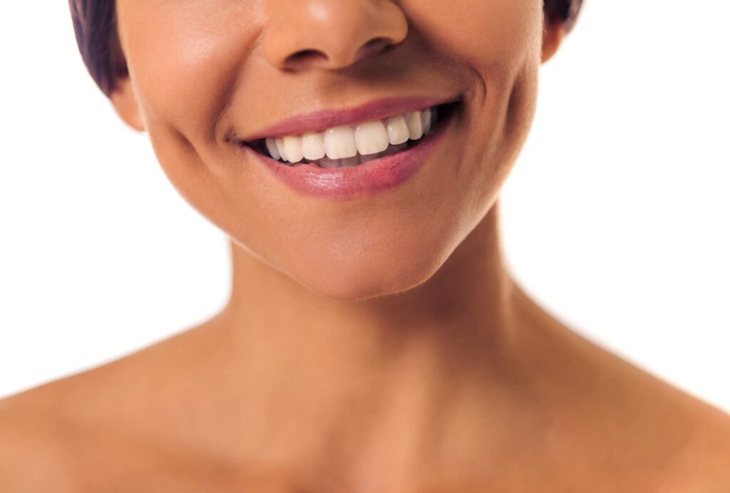 smiling women | Hollywood smile cost in Mexico