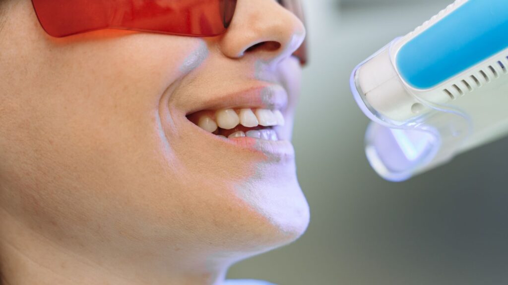Risks by treatment type for a Hollywood smile: teeth whitening in progress with a whitening light and protective glasses.