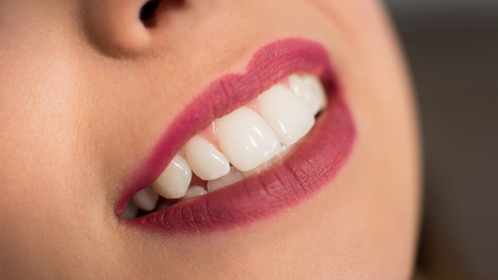 Close-up smile showing upper and lower teeth when deciding if lower veneers are needed