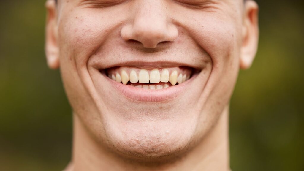 Smiling man with slightly stained teeth illustrating veneer staining from coffee, tea, and dark drinks