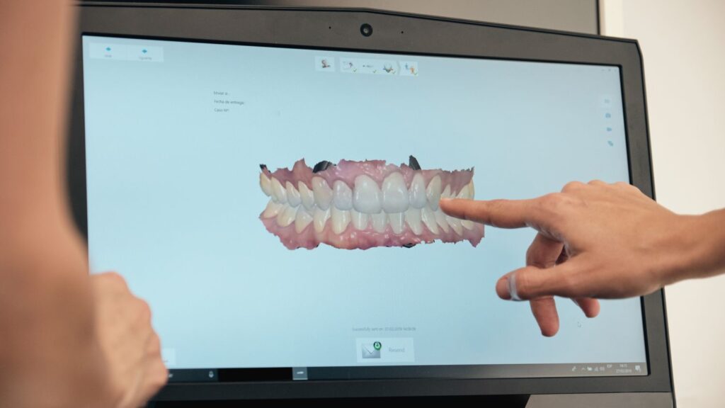 Options in Algeria: what you can choose instead of “full veneers” showing a dentist pointing to a digital 3D smile design on a computer screen.