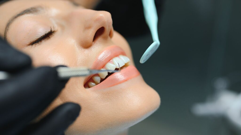 Hollywood smile risks by treatment type, composite bonding: a dentist applies tooth-colored resin to shape the front teeth.