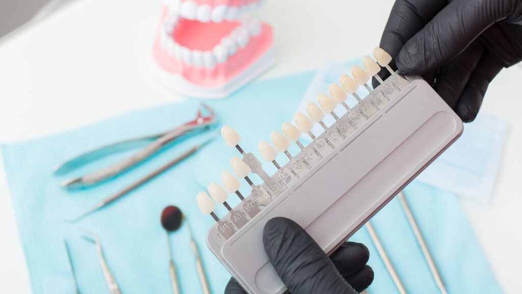 Tooth shade guide held by gloved hands, showing options in Saudi Arabia if you want a better smile without full veneers.