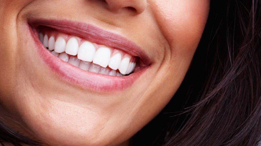 Hollywood smile risks by treatment type, gum contouring: a close-up smile showing the gum line and how reshaping gums can change the look of teeth.