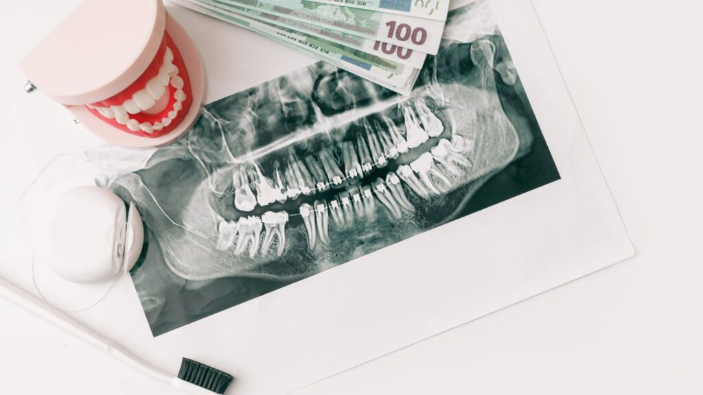 Dental X-ray with Tunisian dinar and dental model illustrating what affects Hollywood smile cost in Tunisia.