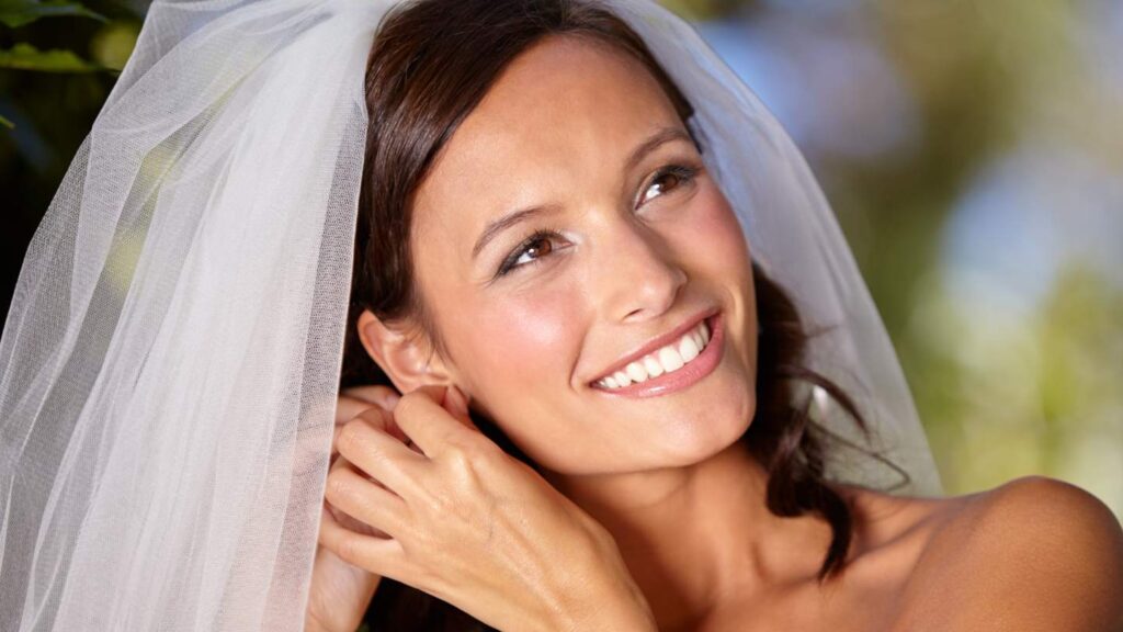 Hollywood Smile for Brides
