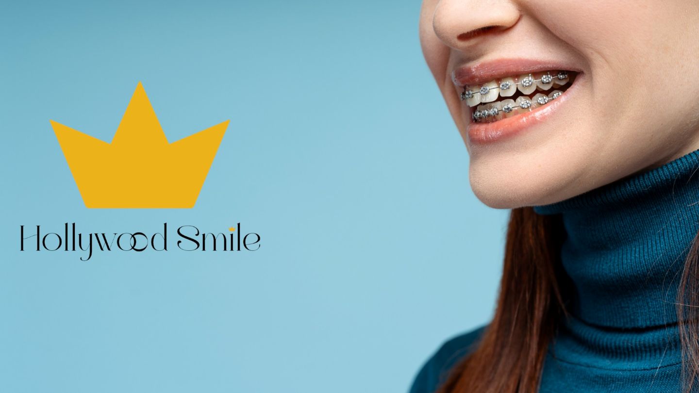 Orthodontics: Types, Benefits, and What to Expect
